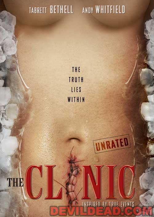 THE CLINIC DVD Zone 1 (USA) 
