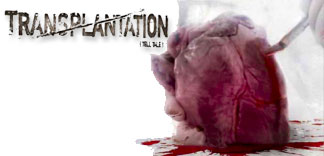 CRITIQUE : TRANSPLANTATION